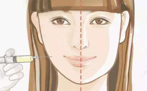 打咬肌多久有效果不打针的话有其他瘦脸建议吗