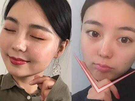 咬肌怎么变小?分享六个快速瘦咬肌的方法